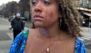 Pro-Life Activist Beaten Bloody By Pro-Abortion Activist